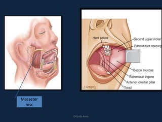 Masseter
msc
DrLaila Amin
 
