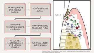 113
LPS are triggered by
gram-negative
bacteria.
PMNs as a first line
defense
Monocytes &
macrophages respond
to endotoxin.
MMPs produced by
fibroblasts & PMNs.
TNF-a, IL-1b &
receptor activator of
of NF-kB ligand
(RANKL)
ICTP transported by
byGCF or saliva
GiannobileWV, BeiklerT, Kinney JS, RamseierCA, MorelliT, WongDT. Saliva as a diagnostictoolfor periodontal disease:currentstateand
futuredirections.Periodontol2000.2009;50:52-64.
 