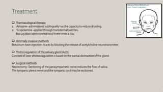 137
Treatment
 Pharmacological therapy
1. Atropine- administered sublingually has the capacity to reduce drooling.
2. Scopolamine -applied through transdermal patches.
800 µg dose administered two/ three times a day.
 Minimally invasive methods
Botulinum toxin injection- it acts by blocking the release of acetylcholine neurotransmitter.
 Photocoagulation of the salivary gland ducts.
Concept of laser photocoagulation is based on the partial destruction of the gland.
 Surgical methods
Neurectomy-Sectioning of the parasympathetic nerve reduces the flow of saliva.
The tympanic plexus nerve and the tympanic cord may be sectioned.
 