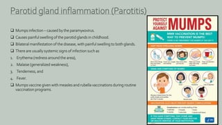  Mumps infection – caused by the paramyxovirus.
 Causes painful swelling of the parotid glands in childhood.
 Bilateral manifestation of the disease, with painful swelling to both glands.
 There are usually systemic signs of infection such as
1. Erythema (redness around the area),
2. Malaise (generalized weakness),
3. Tenderness, and
4. Fever.
 Mumps vaccine given with measles and rubella vaccinations during routine
vaccination programs.
Parotid gland inflammation (Parotitis)
 