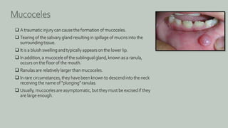  A traumatic injury can cause the formation of mucoceles.
 Tearing of the salivary gland resulting in spillage of mucins into the
surrounding tissue.
 It is a bluish swelling and typically appears on the lower lip.
 In addition, a mucocele of the sublingual gland, known as a ranula,
occurs on the floor of the mouth.
 Ranulas are relatively larger than mucoceles.
 In rare circumstances, they have been known to descend into the neck
receiving the name of “plunging” ranulas.
 Usually, mucoceles are asymptomatic, but they must be excised if they
are large enough.
Mucoceles
 