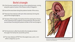 148
 A first line was marked from the tip of the mastoid process, running
along the superior border of the Posterior belly of diagastric.
 Second line was drawn along the posterior border of the ramus.
 These two lines intersect with each other anteriorly, forming the
apex of the triangle (angle a).
 The base of the triangle is formed by third line starting from the tip
of the mastoid process, (angle b) running anteriorly, till it joins the
second drawn line along the posterior border of the ramus (angle c).
 The Facial nerve is often found within this triangle just above
the angle b formed by the 1st and the 3rd line.
 The mean distance of FNT from the angle b was 12.18 ± 2 mm
within a range of 9–15 mm. BorleRM, Jadhav A, Bhola N, HingnikarP, GaikwadP. Borle'striangle: A reliableanatomical
landmarkfor easeof identificationof facial nerve trunkduring parotidectomy.J Oral Biol
Craniofac Res.2019 Jan-Mar;9(1):33-36.
Borle's triangle
 