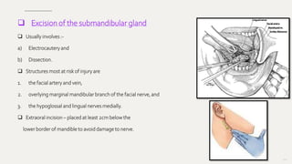  Excision of the submandibular gland
 Usually involves :-
a) Electrocautery and
b) Dissection.
 Structures most at risk of injury are
1. the facial artery and vein,
2. overlying marginal mandibular branch of the facial nerve, and
3. the hypoglossal and lingual nerves medially.
 Extraoral incision – placed at least 2cm below the
lower border of mandible to avoid damage to nerve.
150
 