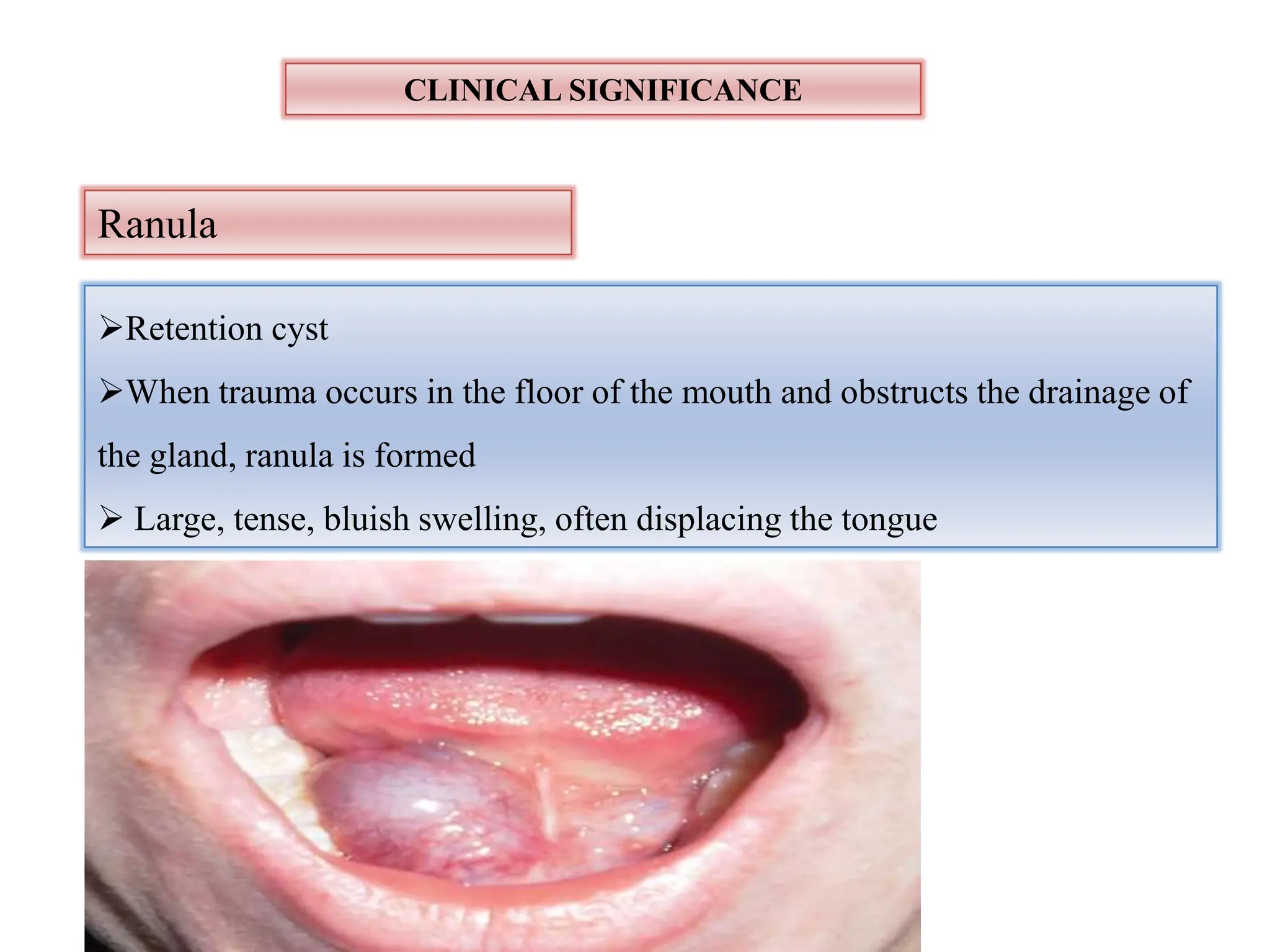 Salivary Gland And Its Importance In Dentistry PPTX salivary-gland-and-its-importance-in-dentistry-pptx