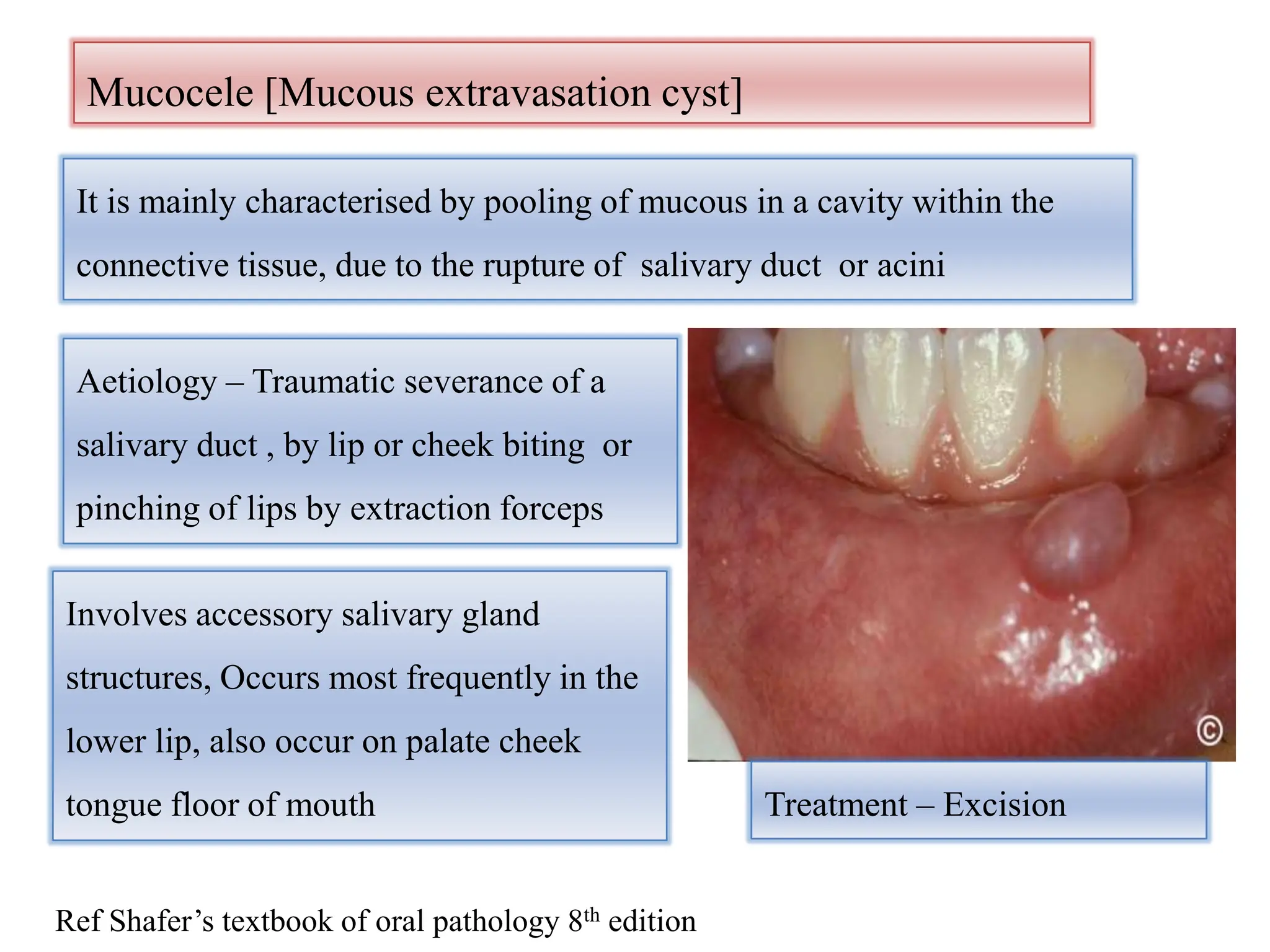 Salivary Gland And Its Importance In Dentistry PPTX