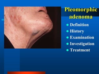 salivary gland diseases..ppt, by professor Dr. Ahmed Al Abbasi | PPT