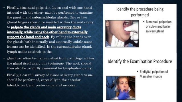 Function Of The Parotid Gland