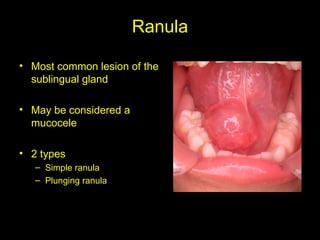 Comprehensive Pathology and Diagnostic Techniques of Salivary Glands | PPT