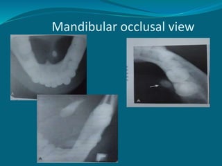 Mandibular occlusal view
 
