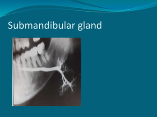 Submandibular gland
 