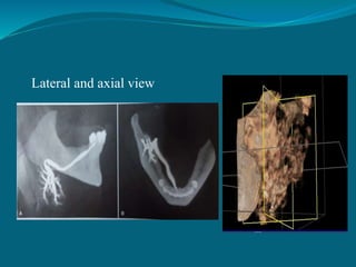Lateral and axial view
 