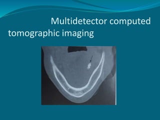 Multidetector computed
tomographic imaging
 