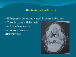 Bacterial sialadenitis
 Sialography contraindicated in acute infections.
 Chronic cases – Sialectasia
(sac like acinar areas).
 Abscess - seen in
MDCT,US,MRI.
 