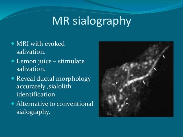 Salivary gland imaging