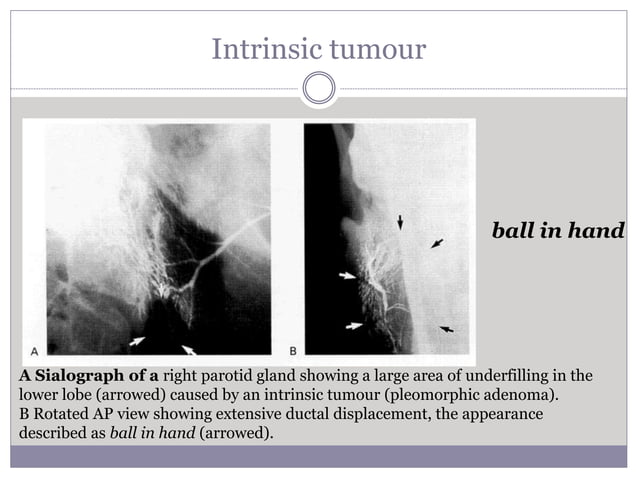 salivary-gland-radiologic-imaging-doc-pptx