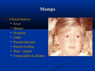 Salivary gland pathology | PPT