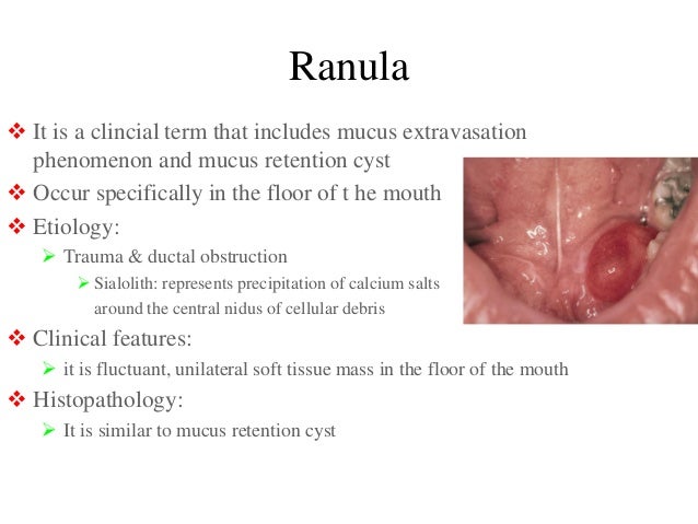 Salivary gland pathoology 1