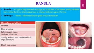 Salivary gland ppt | PPTX
