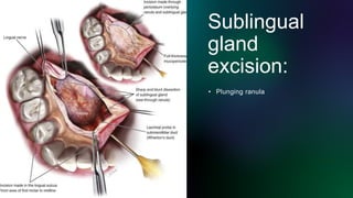disorders of Salivary gland ppt | PPTX