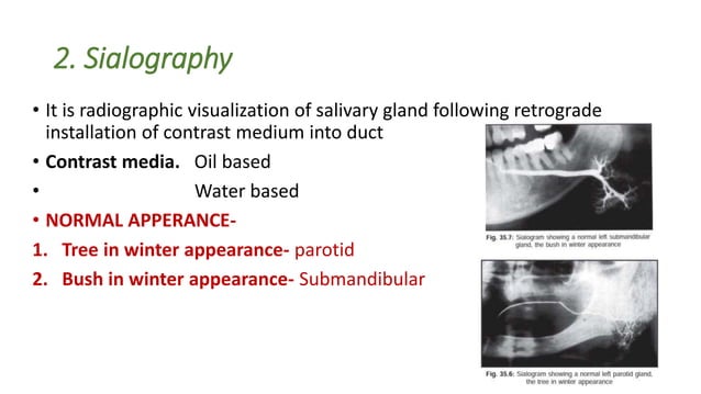 Salivary gland , its disorder and imaging techniques. | PPTX