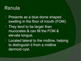 Ranula
 Presents as a blue dome shaped
  swelling in the floor of mouth (FOM).
 They tend to be larger than
  mucoceles & can fill the FOM &
  elevate tongue.
 Located lateral to the midline, helping
  to distinguish it from a midline
  dermoid cyst.
 