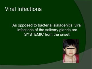 Viral Infections

   As opposed to bacterial sialadenitis, viral
      infections of the salivary glands are
          SYSTEMIC from the onset!
 