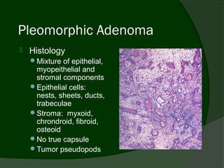 Pleomorphic Adenoma
   Histology
    Mixture of epithelial,
     myopeithelial and
     stromal components
    Epithelial cells:
     nests, sheets, ducts,
     trabeculae
    Stroma: myxoid,
     chrondroid, fibroid,
     osteoid
    No true capsule
    Tumor pseudopods
 