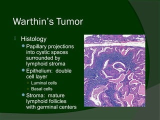 Warthin’s Tumor
   Histology
    Papillary projections
     into cystic spaces
     surrounded by
     lymphoid stroma
    Epithelium: double
     cell layer
      ○ Luminal cells
      ○ Basal cells
    Stroma: mature
      lymphoid follicles
      with germinal centers
 
