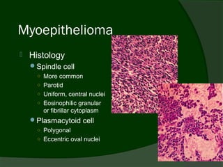 Myoepithelioma
   Histology
    Spindle cell
      ○ More common
      ○ Parotid
      ○ Uniform, central nuclei
      ○ Eosinophilic granular
        or fibrillar cytoplasm
    Plasmacytoid cell
      ○ Polygonal
      ○ Eccentric oval nuclei
 