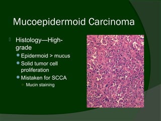 Mucoepidermoid Carcinoma
   Histology—High-
    grade
    Epidermoid > mucus
    Solid tumor cell
     proliferation
    Mistaken for SCCA
     ○ Mucin staining
 