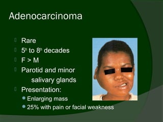 Adenocarcinoma

    Rare
    5th to 8th decades
    F>M
    Parotid and minor
          salivary glands
    Presentation:
     Enlarging mass
     25% with pain or facial weakness
 