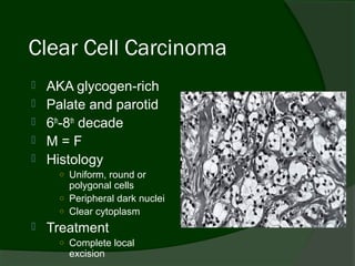 Clear Cell Carcinoma
   AKA glycogen-rich
   Palate and parotid
   6th-8th decade
   M=F
   Histology
      ○ Uniform, round or
        polygonal cells
      ○ Peripheral dark nuclei
      ○ Clear cytoplasm
   Treatment
      ○ Complete local
        excision
 