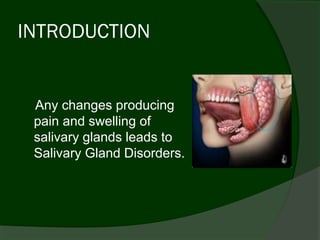 INTRODUCTION


 Any changes producing
 pain and swelling of
 salivary glands leads to
 Salivary Gland Disorders.
 