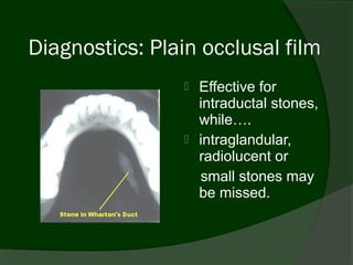 Diagnostics: Plain occlusal film
                    Effective for
                     intraductal stones,
                     while….
                    intraglandular,
                     radiolucent or
                     small stones may
                     be missed.
 