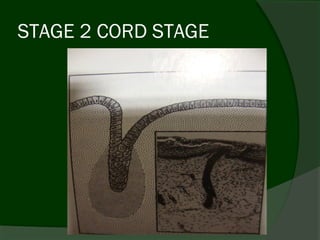 STAGE 2 CORD STAGE
 
