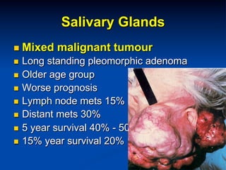 Salivary Glands
n  Mixed

malignant tumour

Long standing pleomorphic adenoma
n  Older age group
n  Worse prognosis
n  Lymph node mets 15%
n  Distant mets 30%
n  5 year survival 40% - 50%
n  15% year survival 20%
n 

 