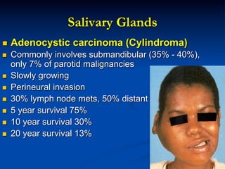 Salivary Glands
n 

Adenocystic carcinoma (Cylindroma)

n 

Commonly involves submandibular (35% - 40%),
only 7% of parotid malignancies
Slowly growing
Perineural invasion
30% lymph node mets, 50% distant mets
5 year survival 75%
10 year survival 30%
20 year survival 13%

n 
n 
n 
n 
n 
n 

 