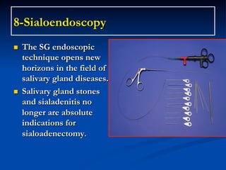 8-Sialoendoscopy
n 

n 

The SG endoscopic
technique opens new
horizons in the field of
salivary gland diseases.
Salivary gland stones
and sialadenitis no
longer are absolute
indications for
sialoadenectomy.

 