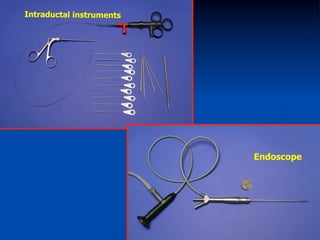 Intraductal instruments

Endoscope

 