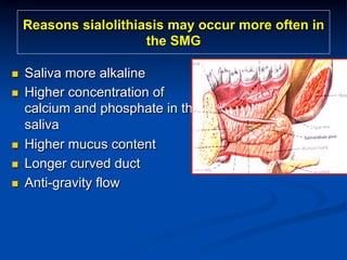 Reasons sialolithiasis may occur more often in
the SMG
n 
n 

n 
n 
n 

Saliva more alkaline
Higher concentration of
calcium and phosphate in the
saliva
Higher mucus content
Longer curved duct
Anti-gravity flow

 