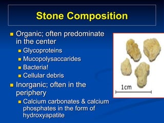 Stone Composition
n 

Organic; often predominate
in the center
n  Glycoproteins
n  Mucopolysaccarides
n  Bacteria!
n  Cellular

n 

debris

Inorganic; often in the
periphery
n  Calcium

carbonates & calcium
phosphates in the form of
hydroxyapatite

 