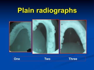 Plain radiographs

One

Two

Three

 