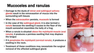 Salivary glands.pptx