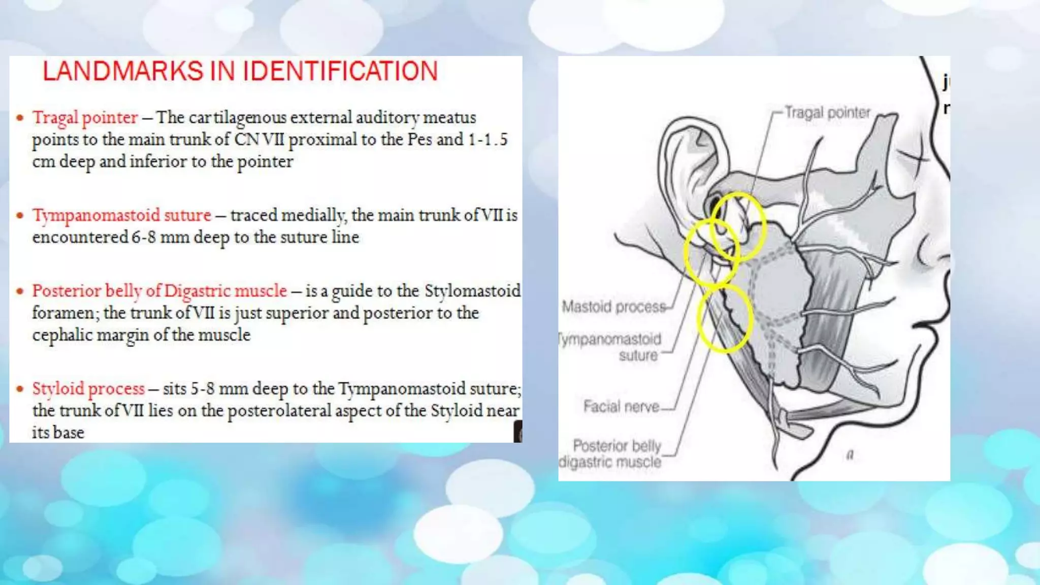 Surgical anatomy of Salivary glands - ORAL AND MAXILLOFACIAL SURGERY | PPTX