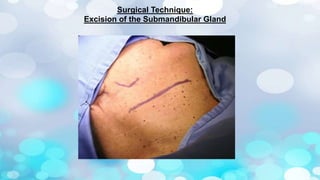 Sublabial Excision Surgical anatomy of Salivary glands - ORAL AND MAXILLOFACIAL SURGERY | PPTX