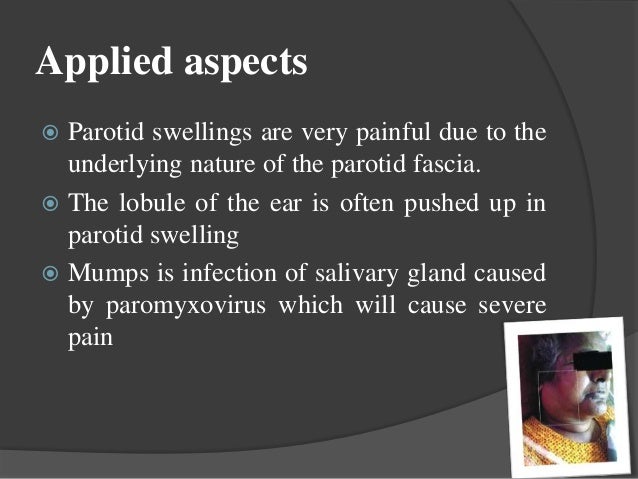 salivary glands and saliva parotid swellings