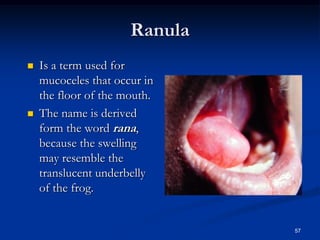 Salivary glands disorders i | PDF