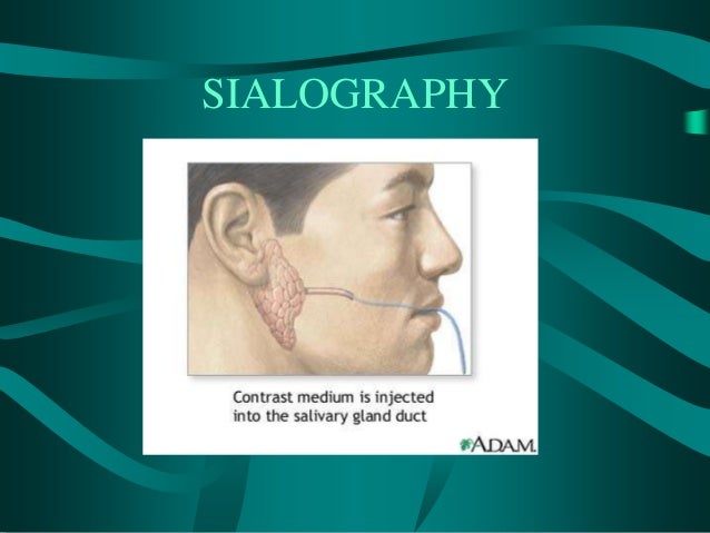 salivary-glands-ppt-vijji