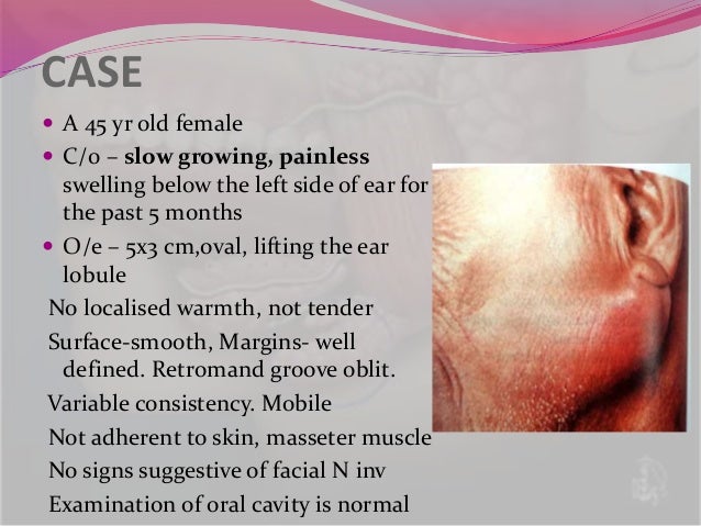 size variable matrix gland 23 Salivary tumors 2016 5 size variable matrix gland 23 Salivary tumors 2016 5