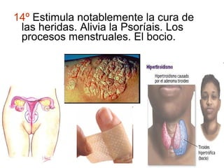 14º Estimula notablemente la cura de
 las heridas. Alivia la Psoríais. Los
 procesos menstruales. El bocio.
 